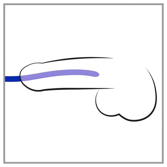 You2Toys - DILATOR - szilikon dilátor szett (3db)